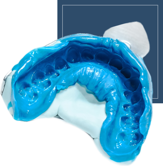 dental mold
