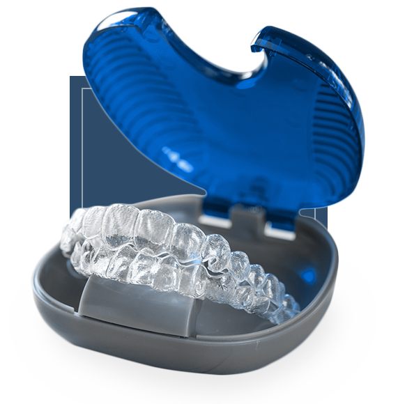 dental aligner